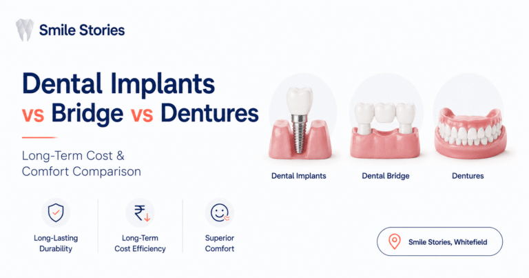 Dental Implants vs Bridge vs Dentures